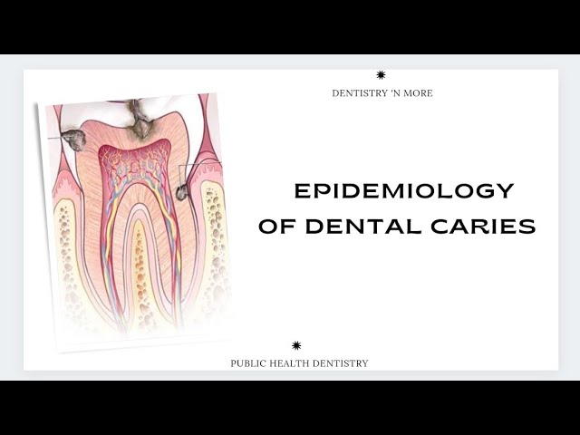 EPIDEMIOLOGY OF DENTAL CARIES