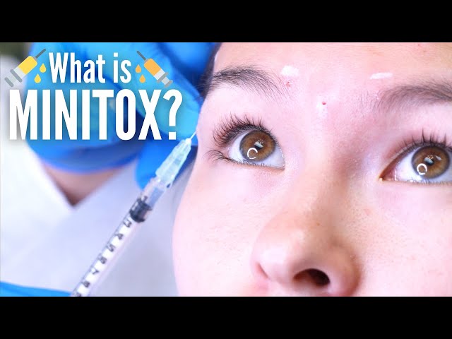 What can Minitox really do? 🤔💉 Use botox, Dysport, or Xeomin to get natural results.