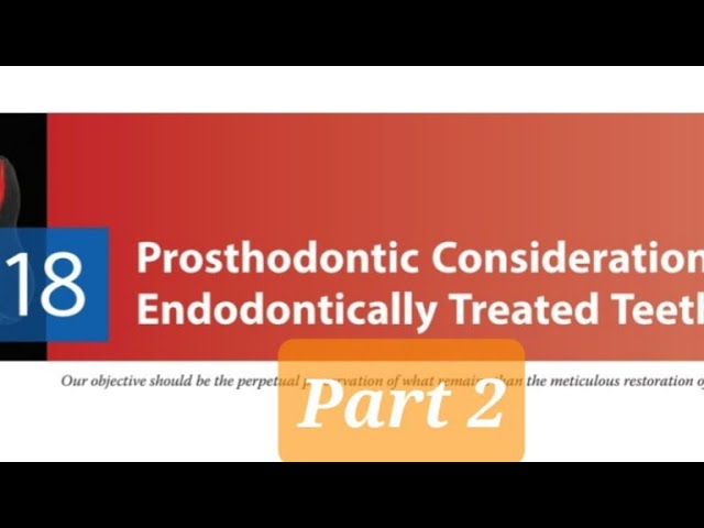 Prosthodontic Considerations in RCT Treated Teeth 2|Factors affecting post selection|Types of Posts.