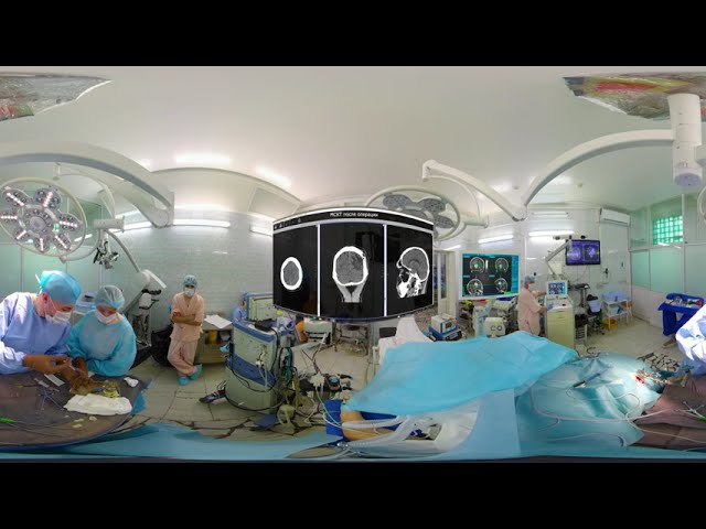 Стереотаксическая безрамочная пункционная биопсия (360 VR video)