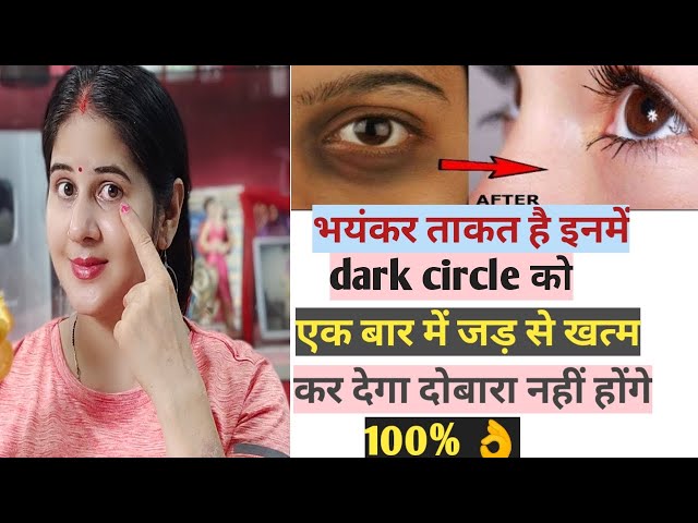 YouTube पर dark circle को ठीक करने की भयंकर दवाई किसी ने नहीं बताई होगी दोबारा नहीं होंगे#darkcircle