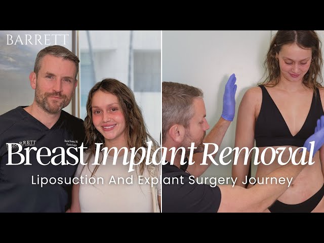 Implant Removal & Fat Transfer Surgery ft. Mikayla Matthews | Barrett