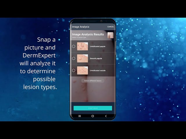 DermExpert Walkthrough Video for Android