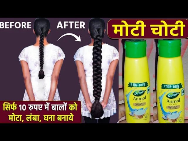 रूखे सूखे बेजान बालों में भी डाल देगा एक नई जान - 100% नए बाल उगाएँ | DIYPowerful Hair Growth Serum