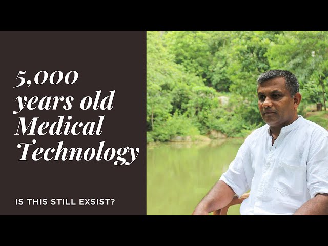 World's oldest medical science with 5,000 years old evidence | අවුරුදු 5,000ක් පැරණි වෛද්‍ය විද්‍යාව