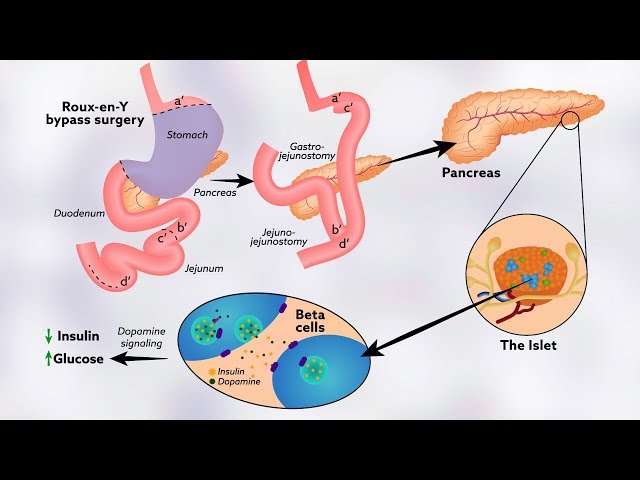 How tyrosine might help regulate glucose levels