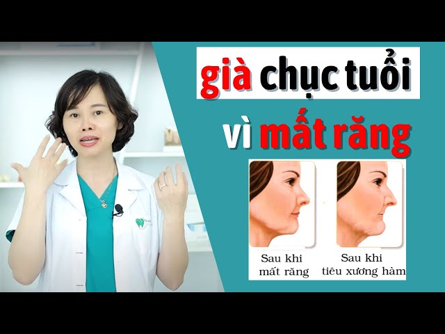 Mất Răng - Tiêu Xương Hàm Đáng Lo Không? | Ảnh Hưởng và Giải Pháp Khắc Phục / Bác sĩ Yến Yteeth