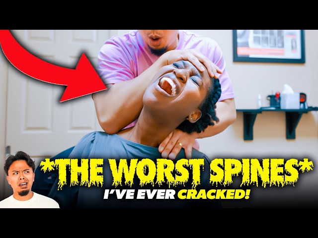 **WORST SPINES** I’VE EVER CRACKED!😱 | Asmr Chiropractic Crunchy Back Pain | Dr Tubio