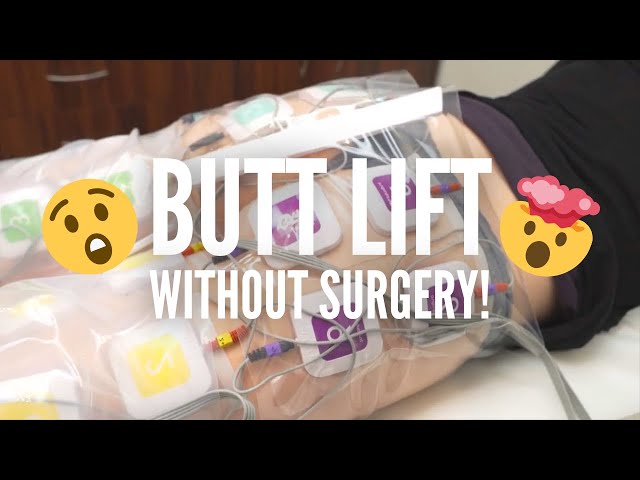 California Butt Lift™ - Dr. Qazi's SAFE alternative to the Brazilian Butt Lift without surgery!