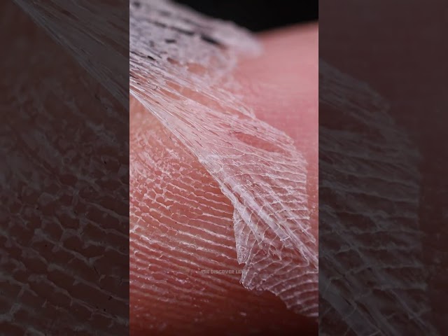 Skin Peeling Macro Closeup – Relaxing ASMR