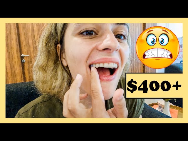 $400+ to get my SMILE back: why so expensive? | Indonesia dentist visit