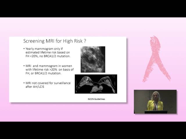 BRCA testing - who needs it?