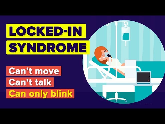 What Is Locked-in Syndrome? Worst Thing That Can Happen To You!