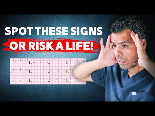 Eighth EKG Patterns in Acute MI We Can't Afford to Miss!