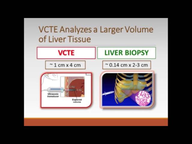 HCV—Assessing the Patient Prior to Treatment: Diagnostic Testing and Staging