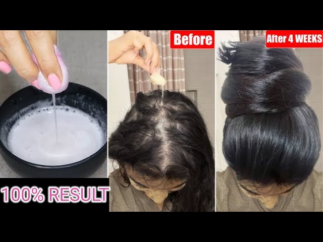 கட்டுக்கடங்காமல் அடர்த்தியா நீளமா முடி வளர இந்த பொருள் போதும்/HairGrowthTips @KeerthiJ-dy2lf  #hair