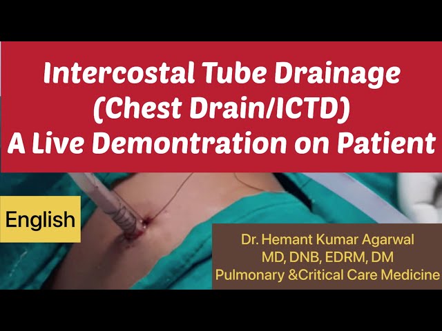 Intercostal Tube Drainage-A Live Demonstration in Patient (English) (Chest Drain/ ICTD) # Chest Tube