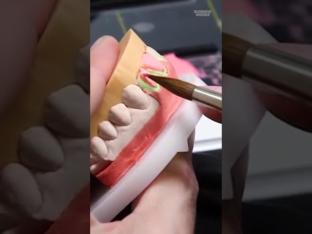 Each tooth on these porcelain veneers costs $4,000. #porcelain #dental #veneers