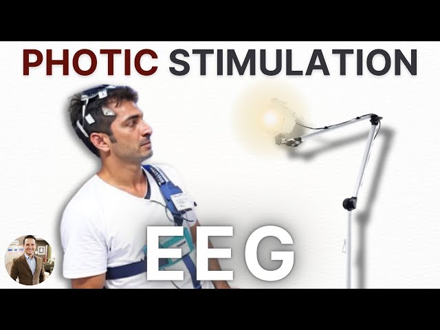 Photic Stimulation on EEG - 4 Facts You Need to Know