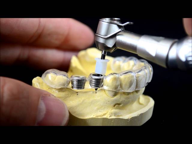 Dental implant surgical guide drilling protocol