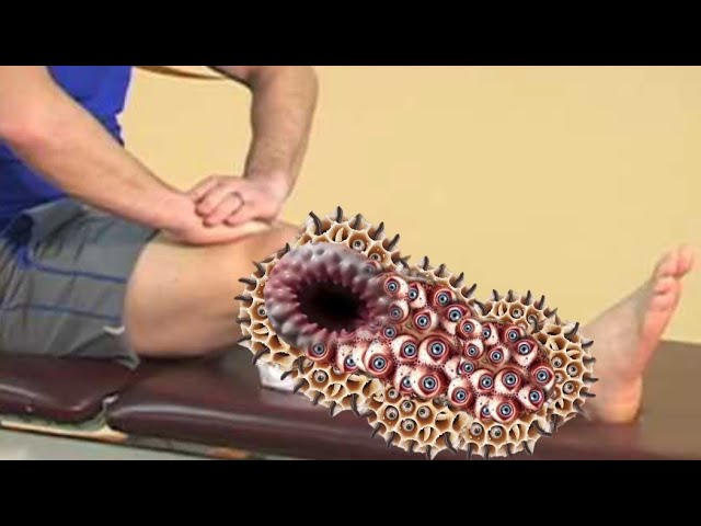 Leg insect and dog maggots removal asmr. 2D animation and best treatment for leg. cleaning treatment