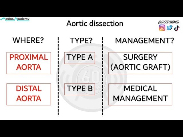 73 SECONDS on the PRESENTATION and MANAGEMENT of AORTIC DISSECTION