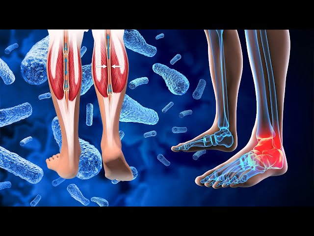 Foot Pain Healing Frequency 528 Hz - Reduce Pain & Stiffness - Overcome Inflammation