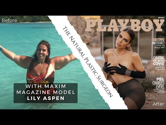 From 300 Pounds To Playboy! | The Natural Plastic Surgeon