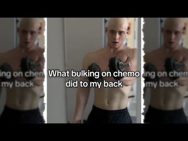 "Bro’s Chemo Scars Go Hard..."🗿