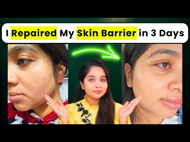 How I Repaired My Skin Barrier in 3 days at Home with Minimal Skincare Products!