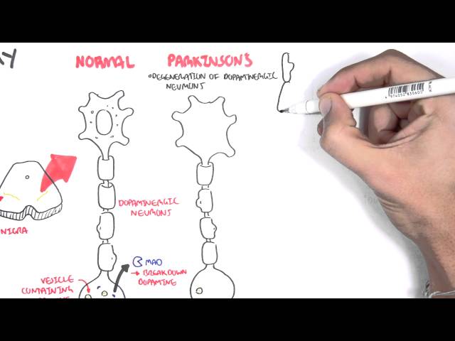 Pharmacology - Parkinson's Disease