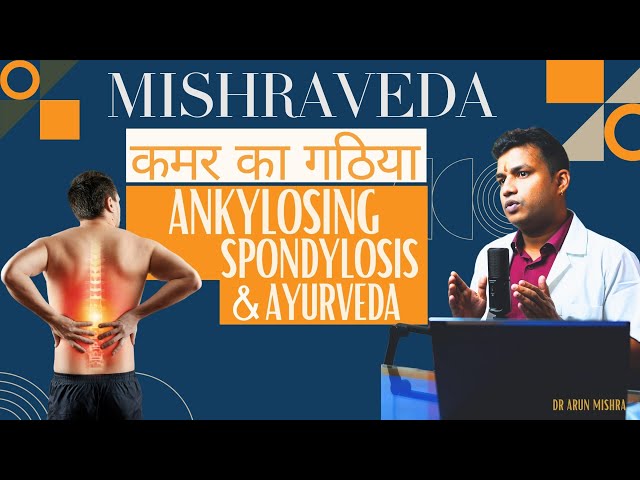 Live-58:Ankylosing spondylosis-कमर का गठिया रोग & आयुर्वेद  #mishraveda #oj Ayurveda #drarunmishra