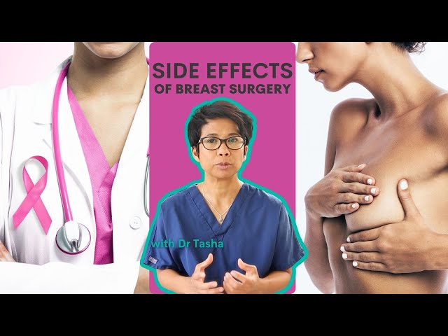 Side Effects of Breast Cancer Surgery - with Dr Tasha