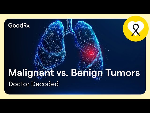 Doctor Decoded: Malignant vs. Benign Tumors | GoodRx