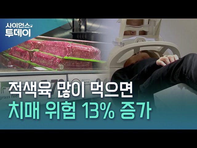 "적색육 많이 먹으면 치매 위험 13% 증가" / YTN 사이언스