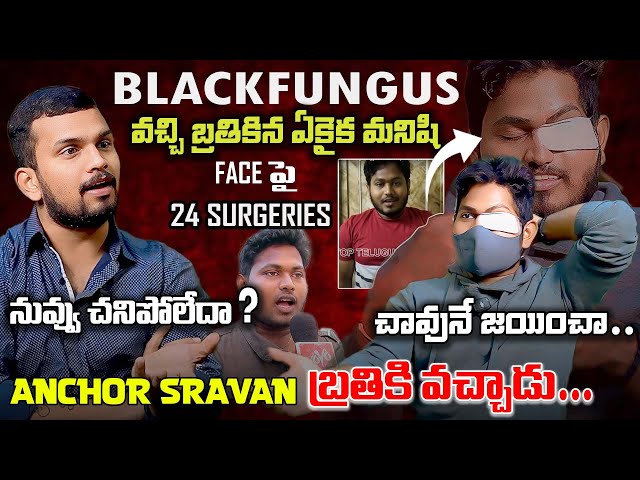 BLACKFUNGUS to BANKMANAGER | Nuvvu Chanipoyav Anukunnam Ra Sravan🥺 || Full Interview  VEDHAAN MEDIA