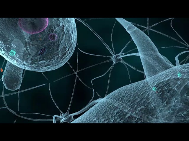 Muerte de las neuronas dopaminergicas en un paciente con parkinson