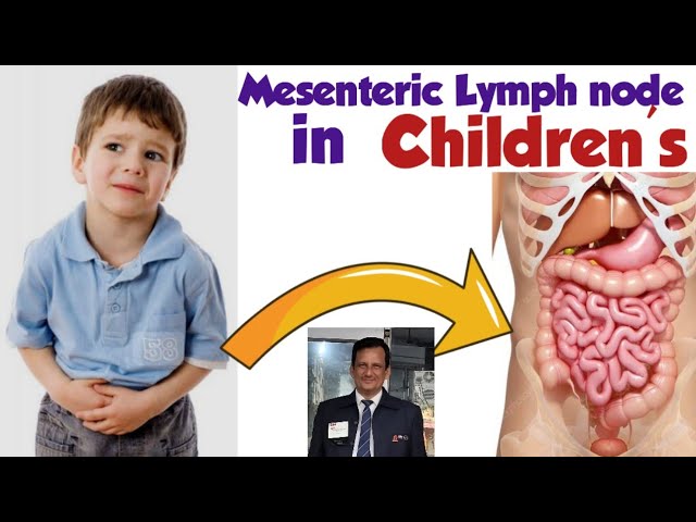 बच्चों के पेट में गांठ क्यों होती है ? Meaning of Mesenteric Lymph Nodes In Childrens #ajaykaushik