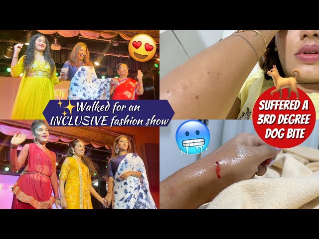 Fashion Show & THEN A Third degree DOG BITE! Traumatic Week in my life! #HustleWSar