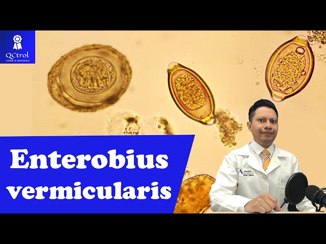 Meet Enterobius vermicularis (Pinworm): Graham Test and adults🔬