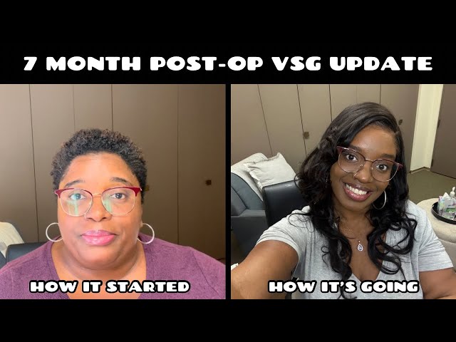 7 MONTHS POST-OP VSG SURGERY | MANAGING CRAVINGS | 145 POUND WEIGHT LOSS | GASTRIC SLEEVE