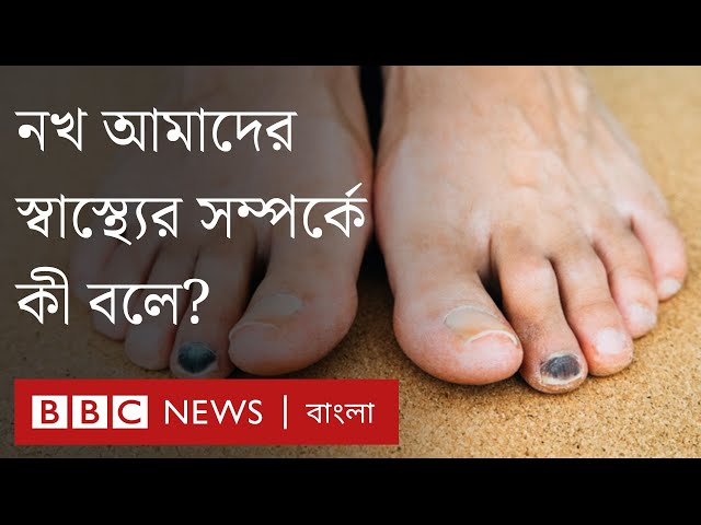 নখ আমাদের স্বাস্থ্যের সম্পর্কে কী বলে? BBC Bangla