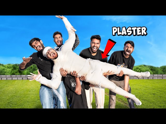 Plaster on My Full Body? मरते मरते बचा | Experiment Gone Wrong