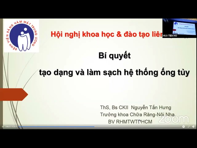 Tạo dáng, làm sạch ống tủy