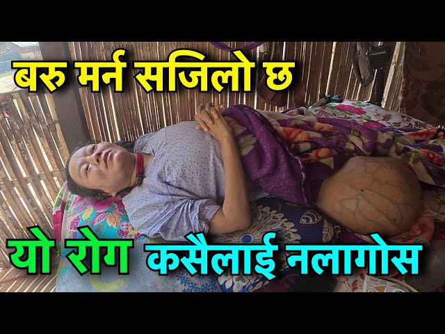 यो रोग लाग्यो भने ज्यान बचाउन गारो हुन्छ !!  Tuki Nepal !! ILLAM  Video  !!