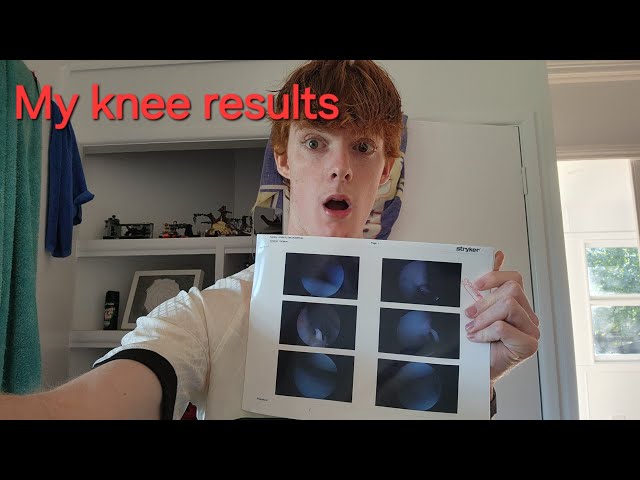 My knee is getting better, I GOT PHOTOS!!!