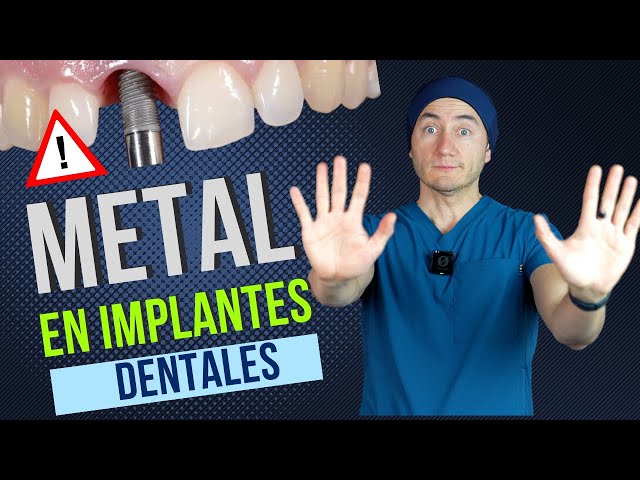 El metal en los implantes dentales te puede dañar mucho