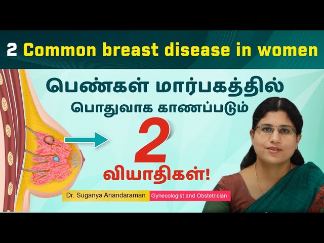 Breast disease in women பெண்கள் மார்பகத்தில் பொதுவாக காணப்படும் 2 வியாதிகள் | Dr Suganya Anandaraman