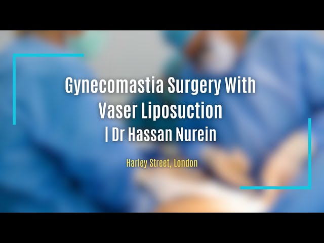 Gynecomastia Surgery With Vaser Liposuction | Dr Hassan Nurein on Harley Street, London