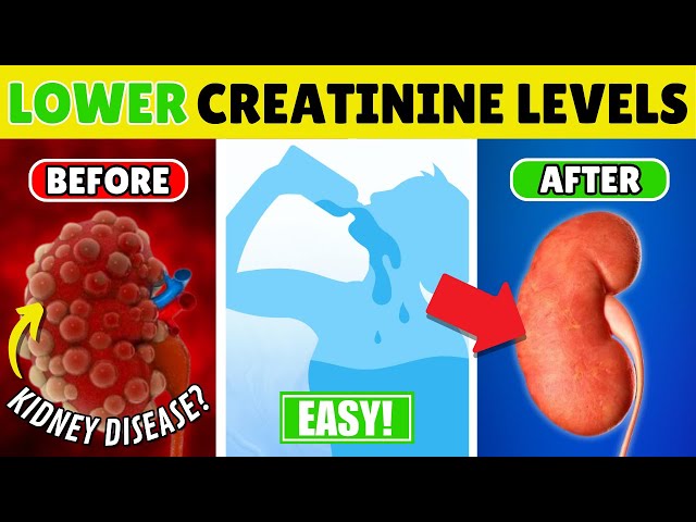 8 SIMPLE Ways To Lower Creatinine Levels